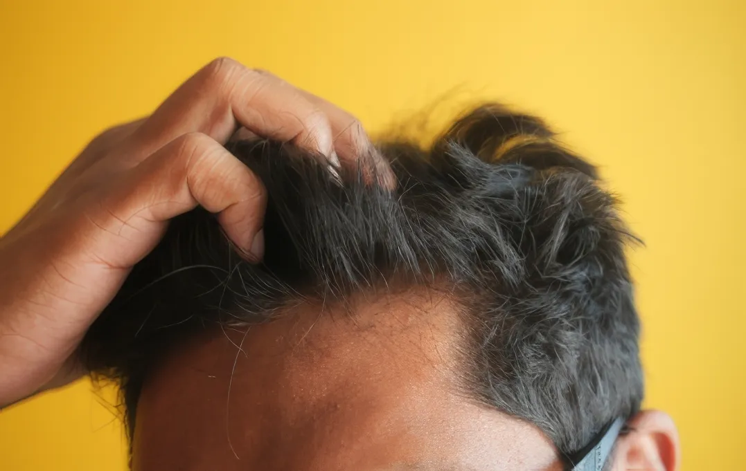 Support hair retention