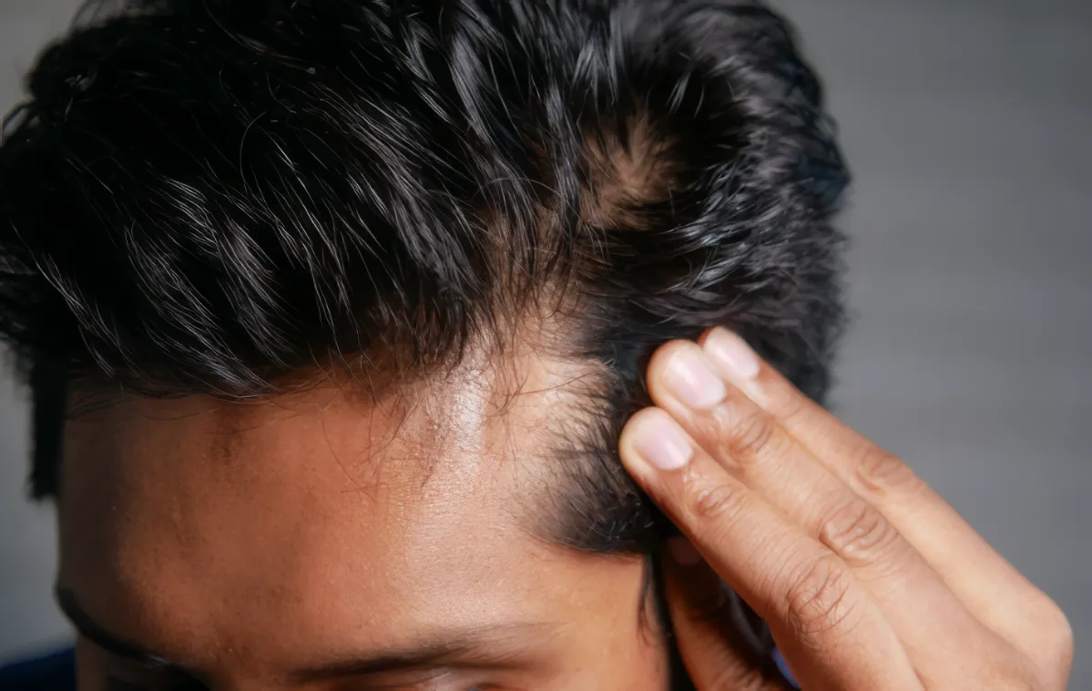 Support regrowth