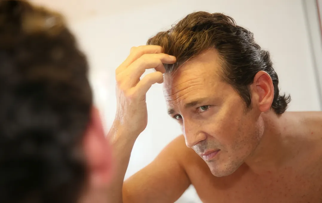 Reduce hair loss